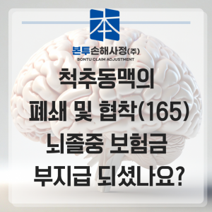 척추동맥의 폐쇄 및 협착(165) 뇌졸중 보험금 부지급 되셨나요?